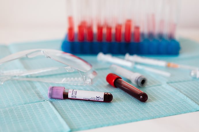 blood samples for testing - Photo by Karolina Grabowska from Pexels