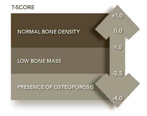 Bone mineral density t-score