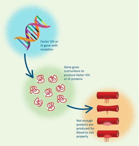 genes in haemophilia