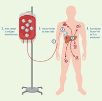 gene therapy infusion process
